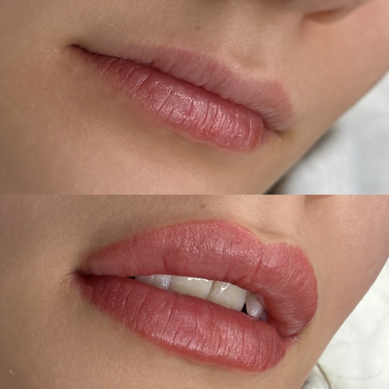 Lippen-PMU Vorher Nachher