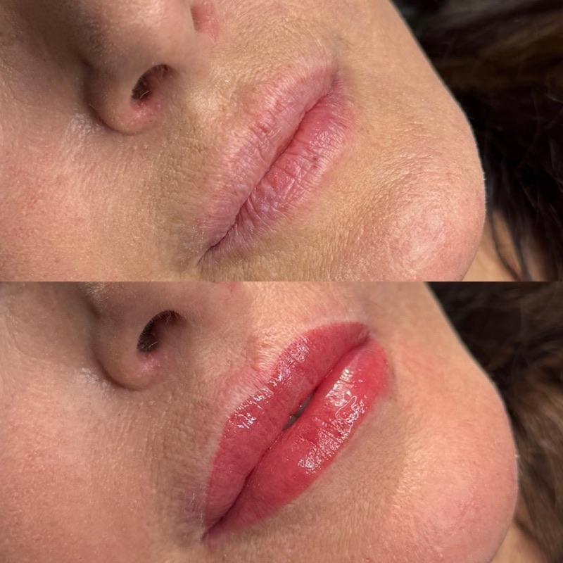 Lippen-PMU Vorher Nachher