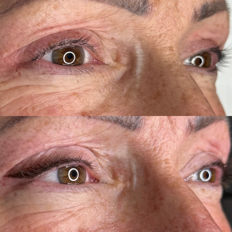 Powder Brows Vorher Nachher